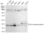 TNFAIP8 Antibody in Western Blot (WB)