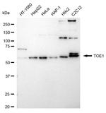 TOE1 Recombinant Rabbit Monoclonal Antibody (24GB1860)