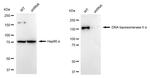 TOP2A Antibody in Western Blot (WB)