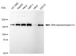 TOP2A Antibody in Western Blot (WB)