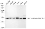 DP1 Antibody in Western Blot (WB)