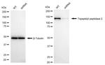 TPP2 Antibody in Western Blot (WB)