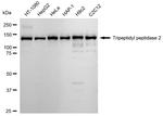 TPP2 Antibody in Western Blot (WB)