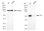 TRK fused gene Antibody in Western Blot (WB)