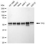 TRK fused gene Antibody in Western Blot (WB)