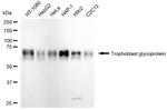 5T4 Antibody in Western Blot (WB)