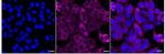 TRPM7 Antibody in Immunocytochemistry (ICC/IF)