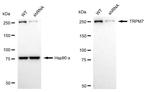 TRPM7 Antibody in Western Blot (WB)
