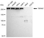 TRPM7 Antibody in Western Blot (WB)