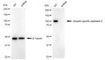 USP5 Antibody in Western Blot (WB)