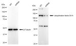 UBE4A Antibody in Western Blot (WB)