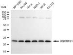 UQCRFS1 Antibody in Western Blot (WB)