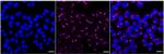 VDP Recombinant Rabbit Monoclonal Antibody (24GB1905)