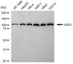 VDP Antibody in Western Blot (WB)