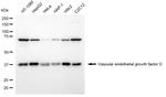 VEGFD Antibody in Western Blot (WB)