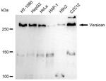 Versican Antibody in Western Blot (WB)