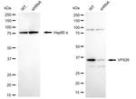 VPS26A Antibody in Western Blot (WB)