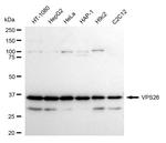 VPS26A Antibody in Western Blot (WB)