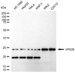 VPS28 Recombinant Rabbit Monoclonal Antibody (24GB1755)