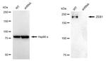 ZEB1 Antibody in Western Blot (WB)