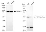 ZPR1 Antibody in Western Blot (WB)
