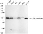 ZPR1 Antibody in Western Blot (WB)