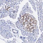 ATF6 Antibody in Immunohistochemistry (Paraffin) (IHC (P))