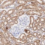ATF6 Antibody in Immunohistochemistry (Paraffin) (IHC (P))