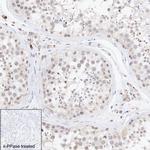 Phospho-IRF3 (Ser396) Antibody in Immunohistochemistry (Paraffin) (IHC (P))