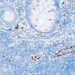 ERG Antibody in Immunohistochemistry (Paraffin) (IHC (P))