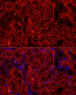 CYP2E1 Recombinant Rabbit Monoclonal Antibody (5G8P6)