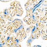 VE-cadherin Antibody in Immunohistochemistry (Paraffin) (IHC (P))