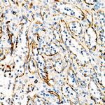 VE-cadherin Antibody in Immunohistochemistry (Paraffin) (IHC (P))