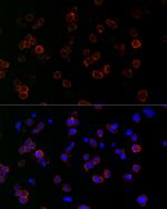 ICAM-1 Recombinant Rabbit Monoclonal Antibody (7A4X3)
