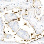 ICAM-1 Antibody in Immunohistochemistry (Paraffin) (IHC (P))