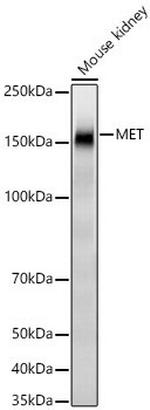 c-Met Antibody in Western Blot (WB)