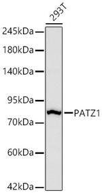 PATZ1 Recombinant Rabbit Monoclonal Antibody (6H7A4)