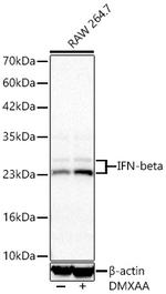 IFN beta Recombinant Rabbit Monoclonal Antibody (6K0L7)