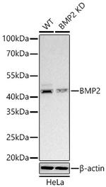 BMP-2 Recombinant Rabbit Monoclonal Antibody (3Q0C7)