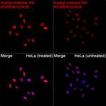 H4ac pan-acetyl (K5,K8,K12,K16) Recombinant Rabbit Monoclonal Antibody (5E2V5)