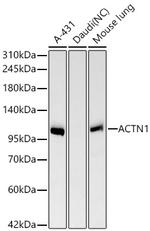 alpha Actinin 1 Antibody in Western Blot (WB)