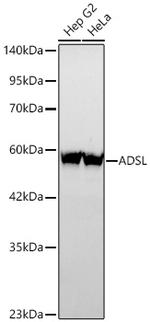 ADSL Recombinant Rabbit Monoclonal Antibody (8J9E10)