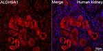 ALDH9A1 Recombinant Rabbit Monoclonal Antibody (6A7Q9)