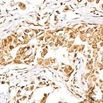 RFWD2 Recombinant Rabbit Monoclonal Antibody (2R8A5)