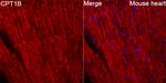 CPT1B Recombinant Rabbit Monoclonal Antibody (0R3Z6)