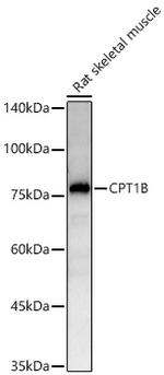 CPT1B Antibody in Western Blot (WB)