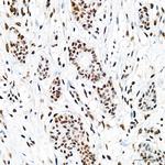 EFTUD2 Antibody in Immunohistochemistry (Paraffin) (IHC (P))