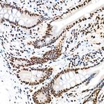 EFTUD2 Antibody in Immunohistochemistry (Paraffin) (IHC (P))
