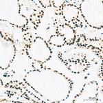 EFTUD2 Antibody in Immunohistochemistry (Paraffin) (IHC (P))