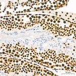 EFTUD2 Antibody in Immunohistochemistry (Paraffin) (IHC (P))